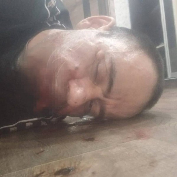 В Башкирии жестоко избили ветерана СВО за то, что он заявил в полицию на мигранта В Башкирии жестоко избили ветерана СВО за то, что он заявил в полицию на мигранта