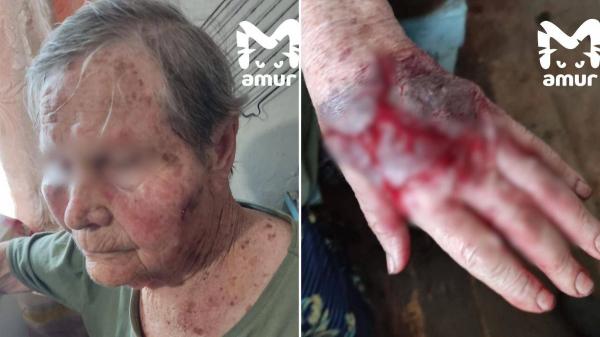 Била до потери сознания: Падчерица зверски избила 85-летнюю вдову ветерана ВОВ из-за денег Била до потери сознания: Падчерица зверски избила 85-летнюю вдову ветерана ВОВ из-за денег
